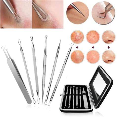 Whitehead removal tool - Professional Facial Milia Removal and Whitehead Extractor & Lancet - Double Ended Circle Loop & Sharp Needle Pimple Tool - 2-in-1 Blackhead & Blemish Remover - Zit and Pimple Acne (Rose Gold) dummy Black Head Remover for Face, Nose Black Head Extractions Tool, Pimple Vacuum Extractor, Pore Cleaner for Men and Women - 4 Probes & 3 Modes